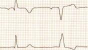 VIII-3index