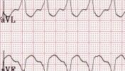 VIII-5index