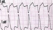 XIV_10index