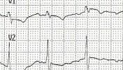 XIV_19index