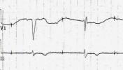 XIV_5index