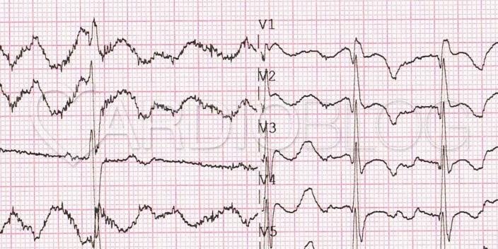 XVIII_1index