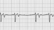 XVII_1index