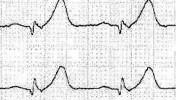 XV_2index